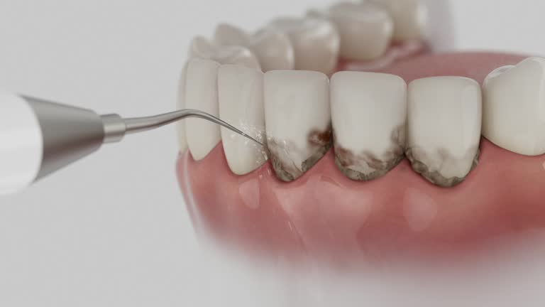 Reliable Dental contractor in Martinsville, IN by Dentist Open Now